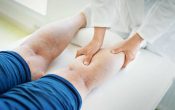 Vein Problems and Vein Treatments