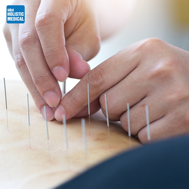 Acupuncture; How it works?